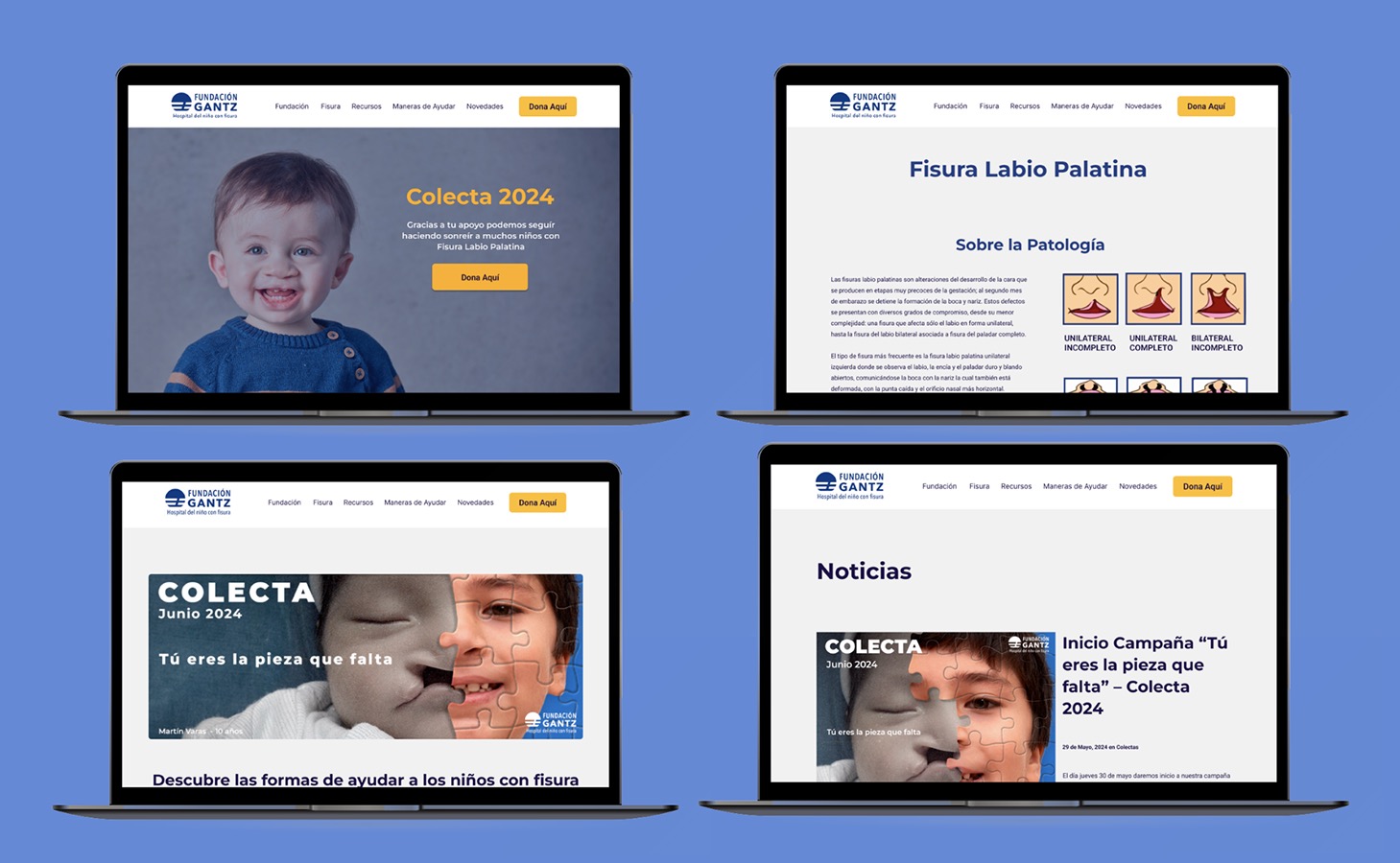 Rediseño Sitio Web Fundación Gantz