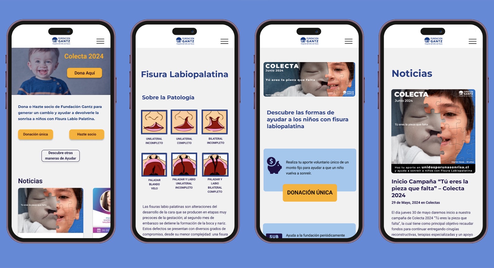 Rediseño Sitio Web Fundación Gantz